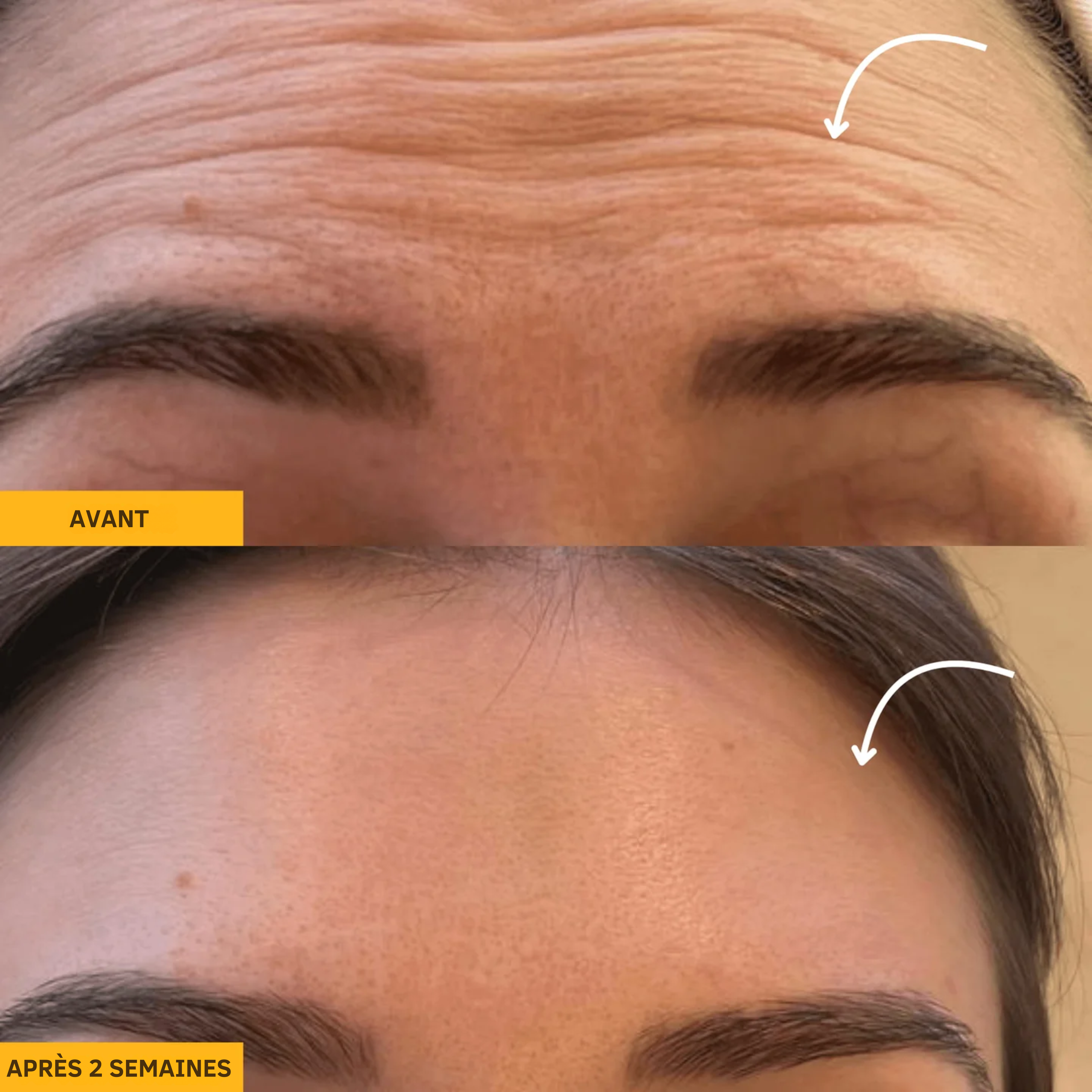 Rituéa I Brosse de massage lymphatique