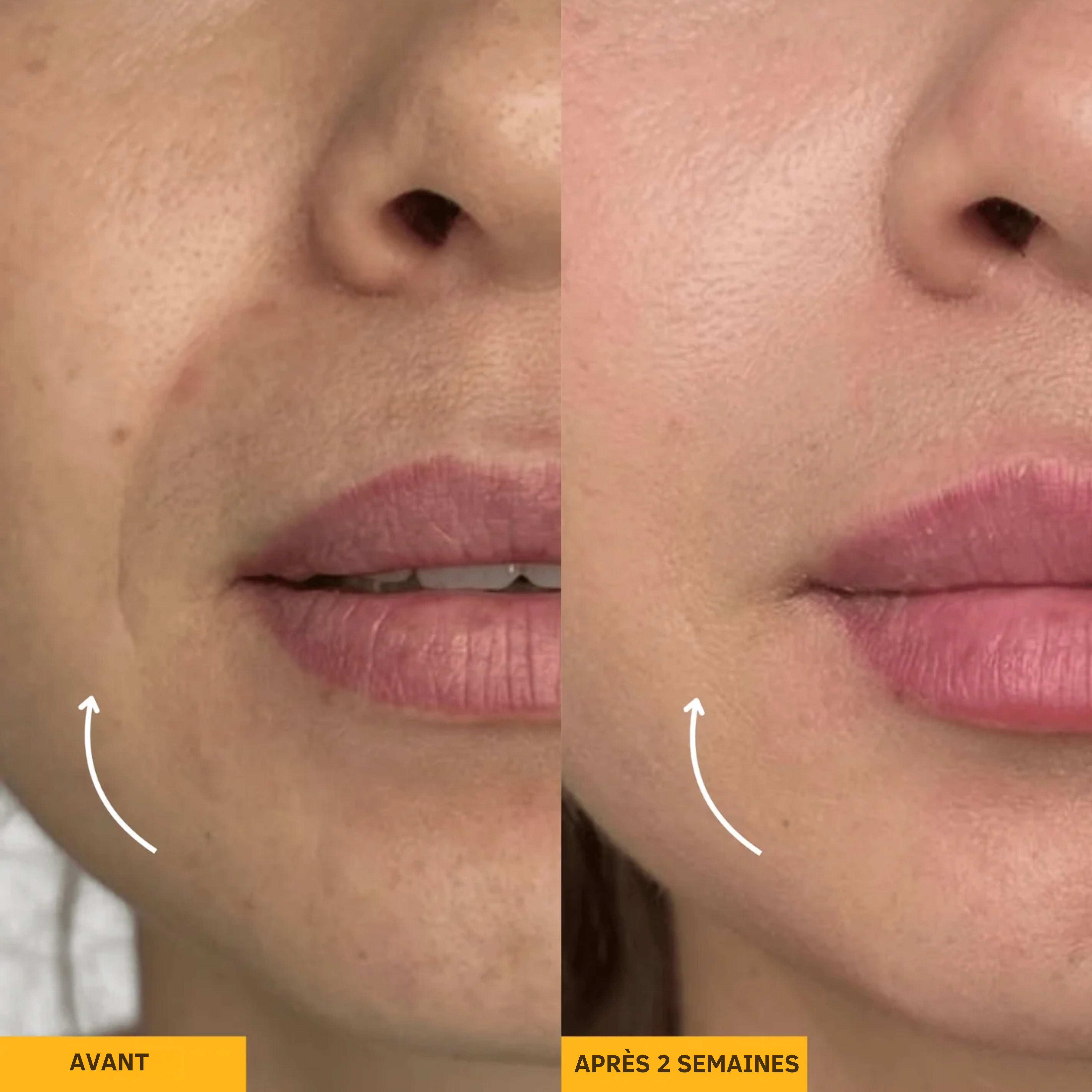 Rituéa I Brosse de massage lymphatique