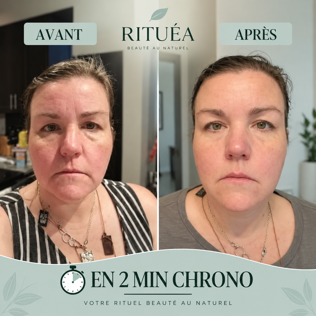 Brosse lymphatique visage RITUÉA