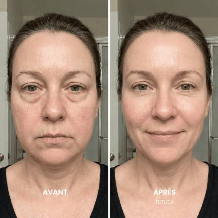 Rituéa I Brosse de massage lymphatique